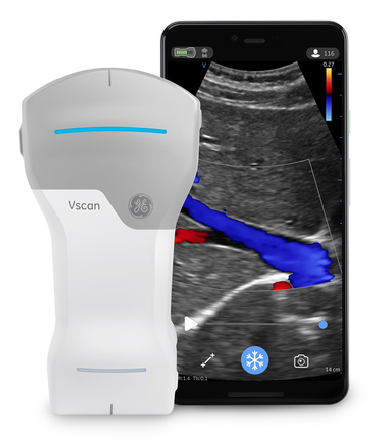 GEヘルスケア・ジャパン／ポケットサイズ超音波診断装置「Vscan Air」を発表