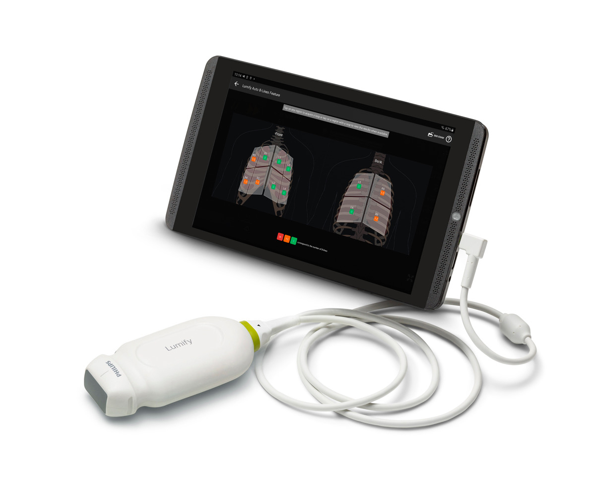 フィリップス／肺検査・診断をサポートするソフトウェアを新たに搭載した超音波診断装置「Lumify （ルミファイ ）」を発売開始