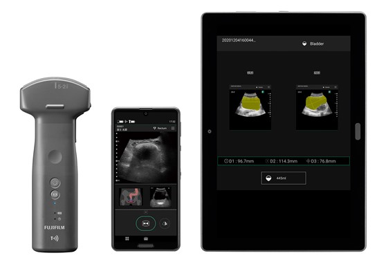 富士フイルムメディカル／ワイヤレス超音波画像診断装置「iViz air Ver.4（アイビズ エアー バージョン フォー）」新発売