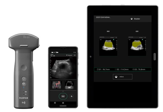 富士フイルムメディカル／ワイヤレス超音波画像診断装置「iViz air Ver