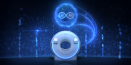 フィリップス・ジャパン／AI 技術によりMRIのさらなる高速化と高画質化を革新  「SmartSpeed Precise」登場（25.4.14）