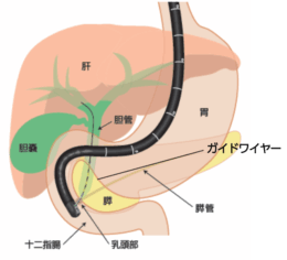 富士フイルム／十二指腸用処置スコープ「ED-840T」新発売（25.9.8）