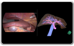 富士フイルム／肝臓領域における術中向けソリューションを新開発（25.12.12）
